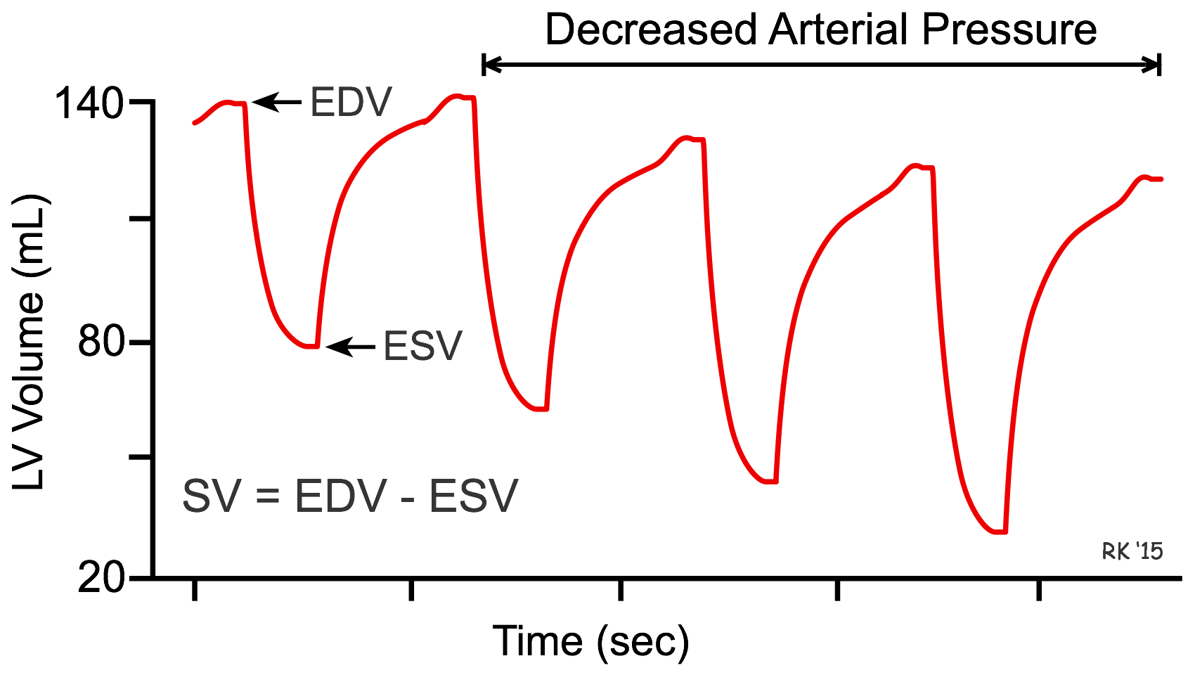 Afterload effects on ventricular volumes